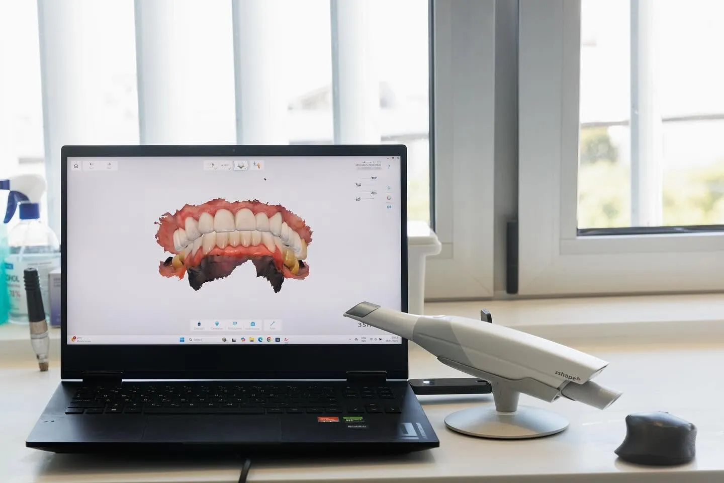 3Shape scan of a smile on screen